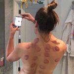 Lea Michele Cupping