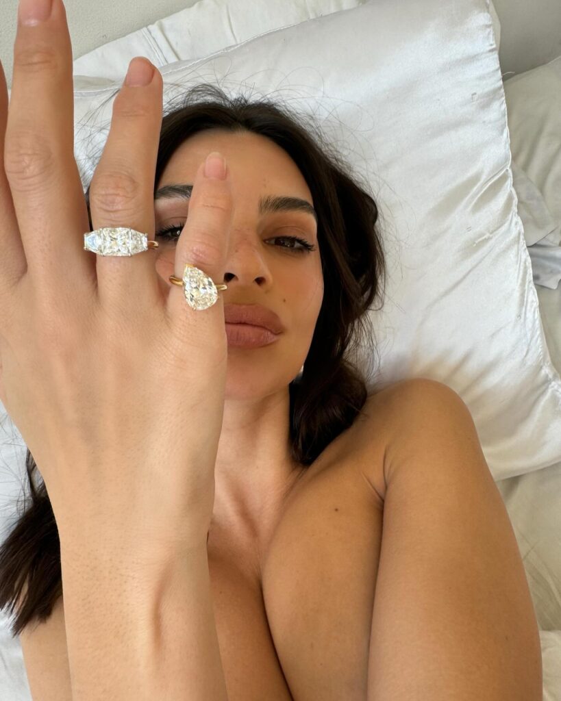 Em Rata’s Hairy Hands Promote Jewelry Topless of the Day